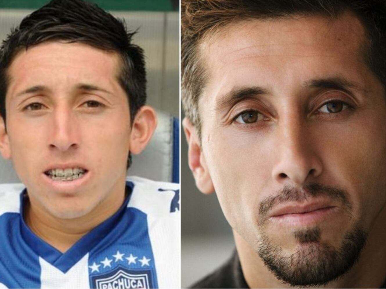 (VIDEOS) Los jugadores mexicanos que se retocaron su rostro con tal de verse más atractivos
